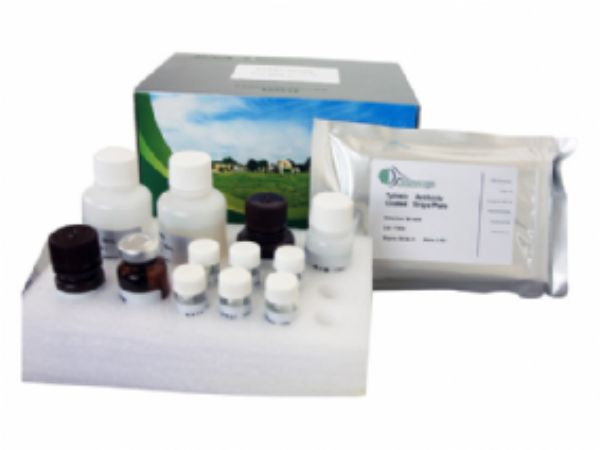 人抗巨细胞病毒抗体IgM(anti-CMV IgM)ELISA试剂盒