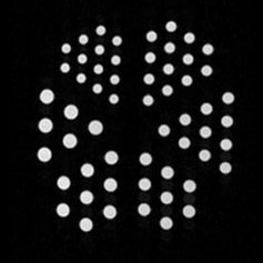 Derenzo分辨率模体,Phantech Derenzo模体