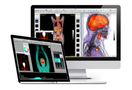 OsiriX MD醫療圖像處理軟件11.0版本已正式發布