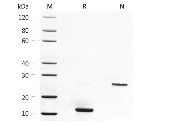 Cytokines 細胞因子產品說明 | MedChemExpress