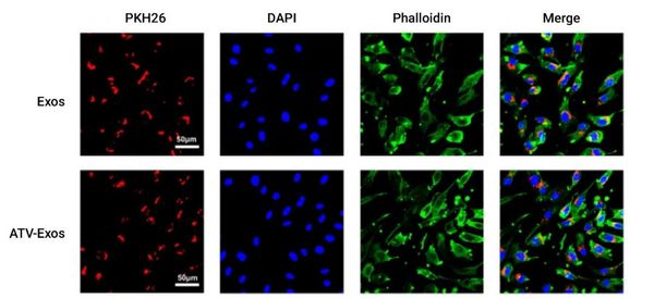 外泌体介绍 - MedChemExpress