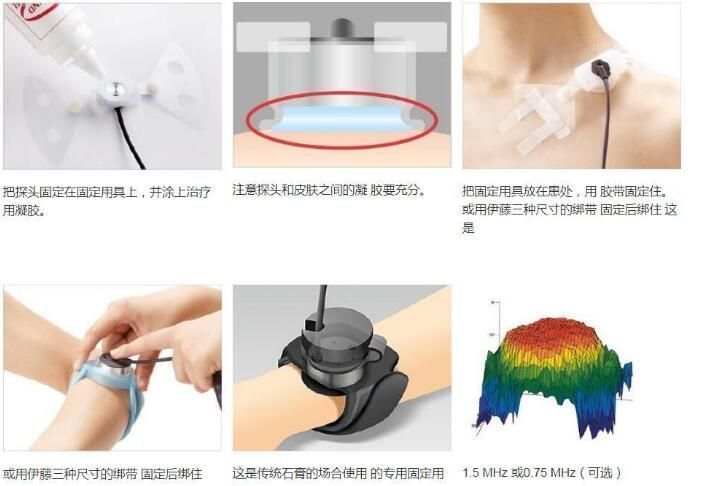 Osteotron IV低能量超聲波骨愈合治療儀